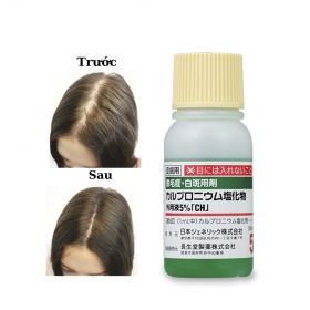 Thuốc mọc tóc Choseido Arovics Solutions 5% chiết xuất thảo dược 30mL